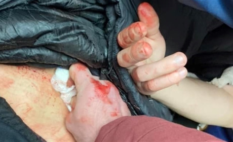 У ненаданні допомоги чоловіку з чотирма ножовими пораненнями звинуватили сокальських медиків
