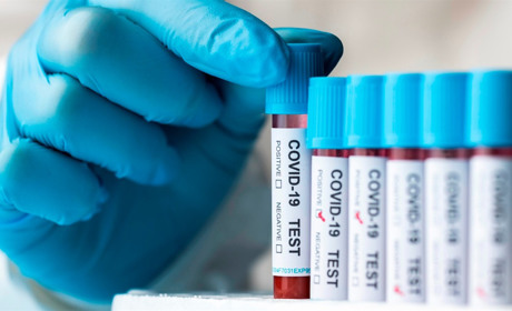 COVID-19 в Україні: яка ситуація з поширенням коронавірусу на Сватівщині і у Луганській області