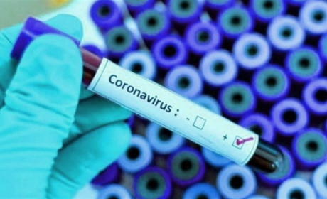 У Кагарлику зареєстровано випадок коронавірусної хвороби