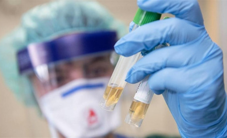 Чутки про коронавірус у Білопіллі спростовано. Тести негативні