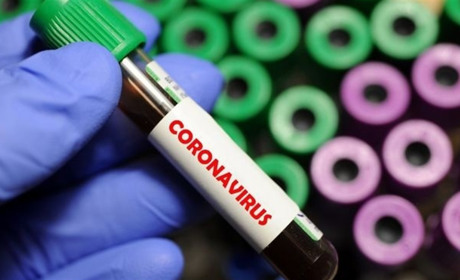 Тести на ковід – в маси