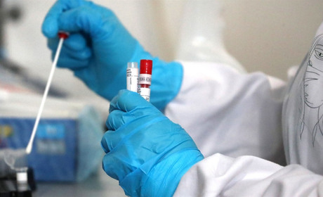 У Жовтих Водах у травні внаслідок COVID-19 помер один пацієнт: статистика хвороби