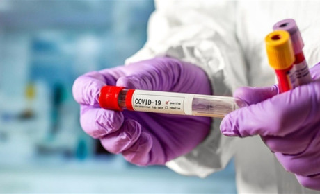 У Львівській області знижується рівень захворюваності на Covid-19