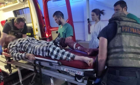 Російські війська обстріляли Торецьк: поранена трирічна дитина