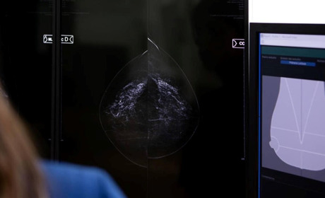 У Сарнах знову працює мамологічний кабінет: як пройти огляд