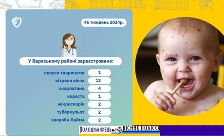 У Вараському районі "лідирує" віспа: статистика тижня