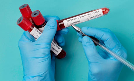 На Луганщині збільшується кількість хворих на COVID-19: яка ситуація у Сватівському районі