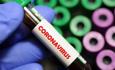 У Херсоні підтвердили іще два випадки захворювання на коронавірус