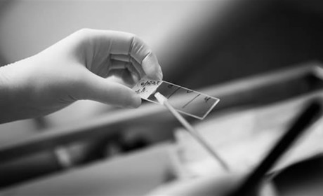 Які генетичні тести можна зробити в ДНК лабораторії ІГР ЛАБ у Києві?