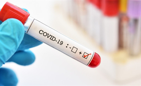 COVID-19 у Сватівському районі: яка ситуація з поширенням хвороби у громаді і на Луганщині