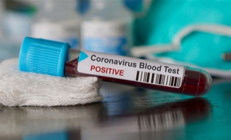 В яких населених пунктах і громадах зареєстровані хворі на COVID-19 станом на 18 жовтня