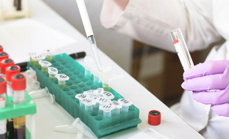 За минулу добу на Луганщині COVID-19 підтвердили ще у двох людей: що на Сватівщині та у країні