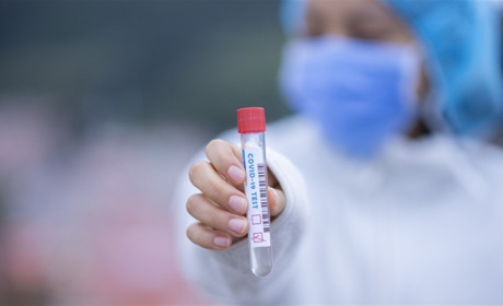 В Южному 34 особи за останню добу захворіли на вірус Covid-19 (ІНФОГРАФІКА)