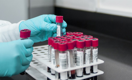 На Луганщині підтвердили четвертий випадок COVID-19. В Україні за добу хворих стало 392