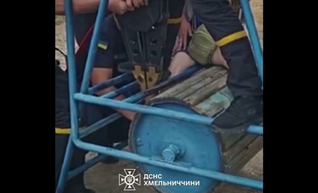 У Нетішині надзвичайники звільнили дівчинку, нога якої застрягла у спортивному тренажері
