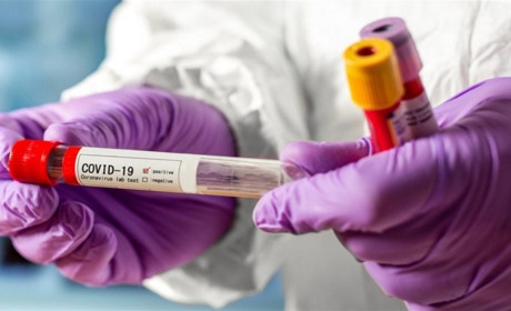 Сьогодні стартував новий етап пом’якшення, а в Запоріжжі є нова жертва коронавірусу