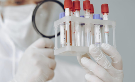 COVID-19 на Луганщині: яка ситуація з поширенням хвороби на Сватівщині на 1 лютого 2022