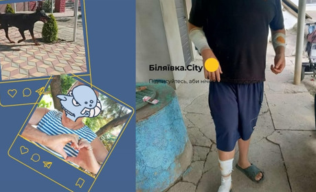 Чоловік закрив собою дитину, рятуючи від собаки в Біляївці. Власник нічим не допоміг