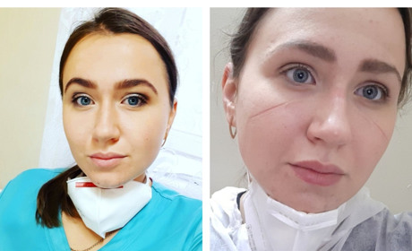 100 дзвінків щодня, 12 годин на ногах, цілодобово на зв'язку: лікарка-інфекціоністка про роботу