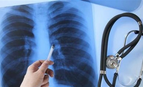 Сватівчани зможуть безкоштовно зробити флюорографію. Селами їздитиме пересувний флюорограф