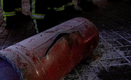 В Одеському районі через несправність газового балону сталася пожежа, постраждали двоє людей