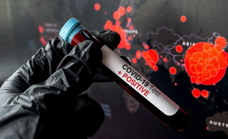 Статистика по коронавірусу на 24 червня: у Вараші – 107 хворих, на Володимиреччині – 79