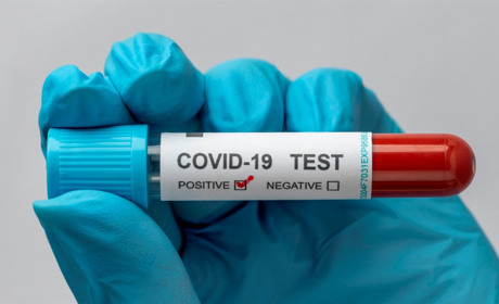 COVID-19 в Україні: яка ситуація з поширенням хвороби у Сватівському районі на ранок 27 січня 2022