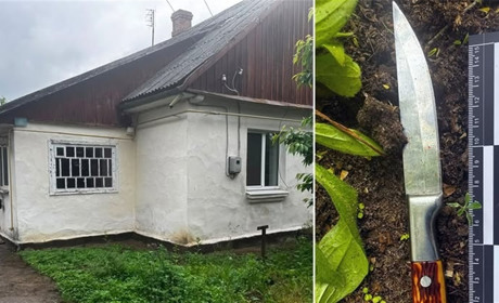 На Славутчині чоловік під час застілля поранив сина ножем