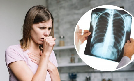 Пневмонія: як розпізнати, лікувати та запобігти небезпечному захворюванню легень