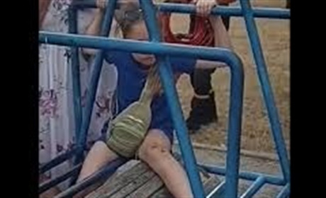 У Нетішині врятували дівчинку, нога якої застрягла у спортивному тренажері