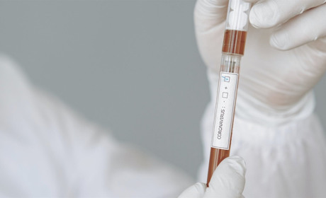 COVID-19 на Сватівщині: за минулу добу у районі у 35 людей підтвердили хворобу, одна людина померла