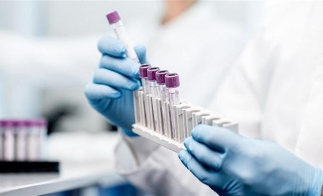 Коронавірус у Сватівському районі: яка ситуація з поширенням COVID-19 у громаді і області