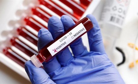 Скільки хворих на коронавірус на Білопільщині та в області?