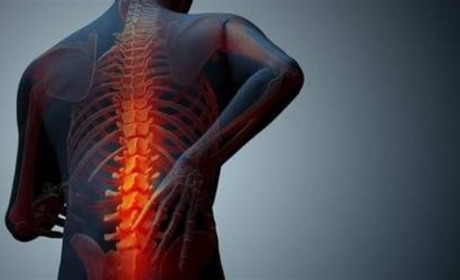 Анкілозуючий спондиліт – коли хребет втрачає рухливість