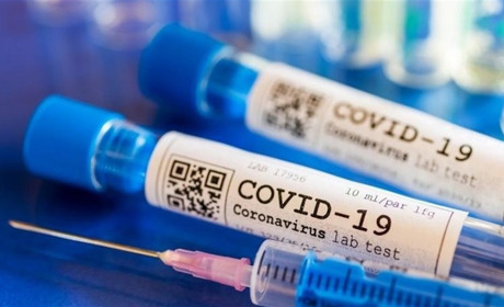 Статистика по коронавірусу на 24 липня: у Вараші – 188 хворих, на Володимиреччині – 133