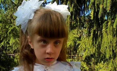 Аня Ковальова зі Сватового вісім років бореться з онкологією: вона пройшла 40 курсів хіміотерапії