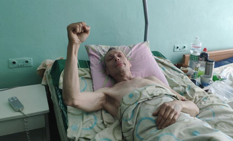 Вибухи у Фастові: потерпілому чоловіку вдалося зберегти ногу