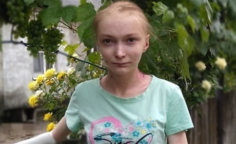 Помоги своим: 16-летняя Аня борется с неизлечимой болезнью и нуждается в помощи
