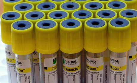 У Луганському лабораторному центрі розповіли, чому не відзвітували МОЗ по тестуванню на коронавірус