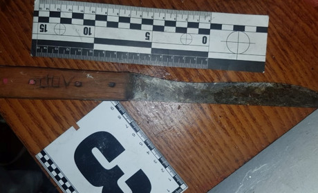 Поліцейські затримали 40-річну славутчанку, яка під час застілля завдала ножових поранень товаришу "