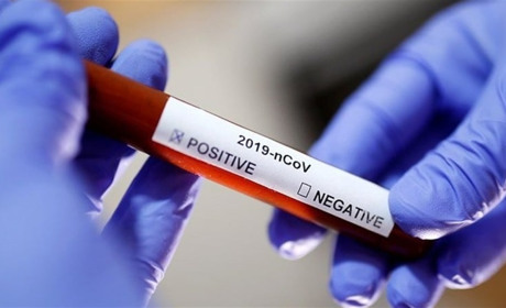 На Сватівщині за три доби +11 хворих на COVID-19: яка ситуація на Луганщині і в країні на 22 березня