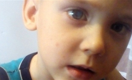 Помоги своим. Двухлетний Женя теряет зрение. Нужна операция по замене хрусталика