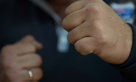 У Переяславі 23-річного хлопця побили біля власного будинку: хроніка поліції