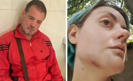 Нетверезий працівник ТЦК та СП побив жінку та втік з місця: що відомо про справу