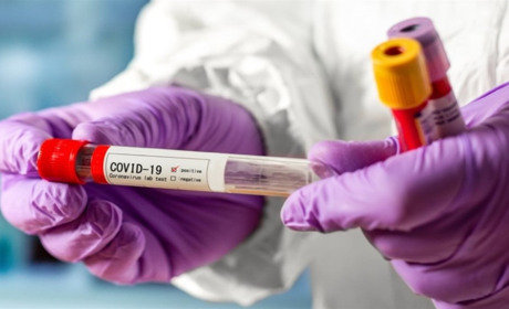 "Корона" наступає: одна жінка померла 14 серпня, наразі у районній лікарні - семеро хворих