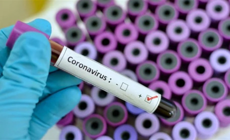 Шість поширених запитань про новий коронавірус: що треба знати сватівчанам, аби вберегтися