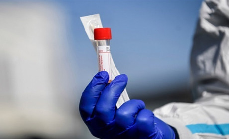 За добу 64 інфікованих, 4 померло