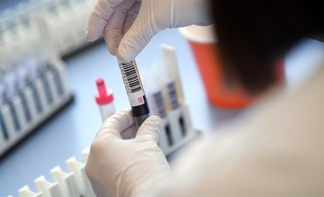 Статистика по коронавірусу на 20 липня: у Вараші – 180 хворих, на Володимиреччині – 131