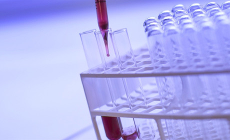 В Україні кількість хворих на COVID-19 зросла до 5449. Яка ситуація на Луганщині і Сватівщині