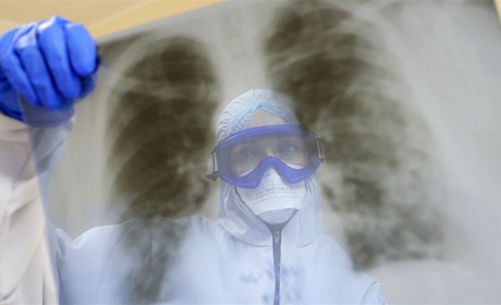 На Білопільщині кількість амбулаторних хворих на ковід зросла в рази. Четверо померли в лікарні